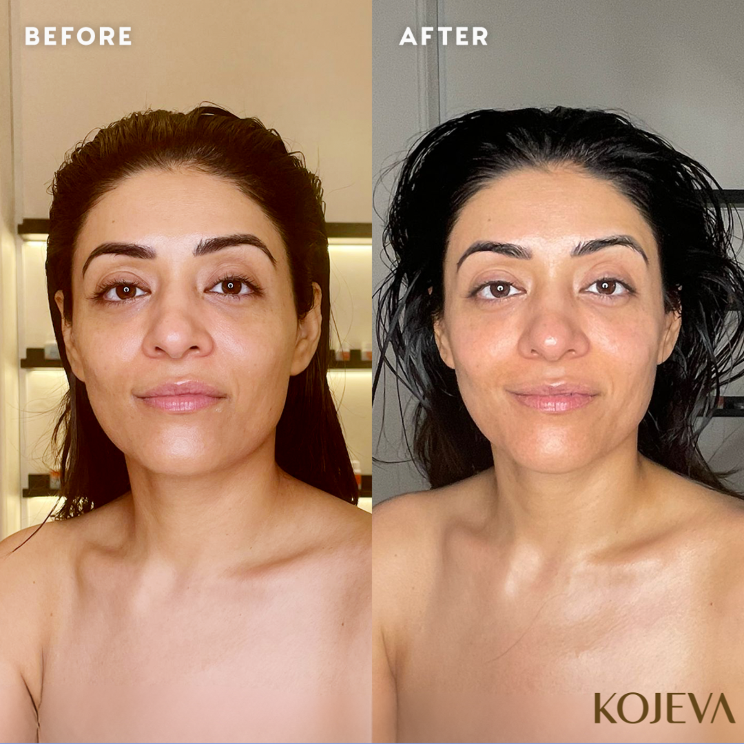 Kojeva Lymphatic Face Brush thumbnail 3